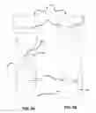 Fig. 05 - Hyperextension brace assembly and methods of use