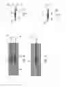 Fig. 09 - Knee orthosis, and method for controlling a knee orthosis
