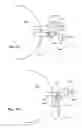 Fig. 08 - Power Generator For Glaucoma Drainage Device