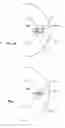 Fig. 11 - Power Generator For Glaucoma Drainage Device
