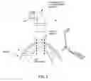 Fig. 03 - METHOD AND APPARATUS FOR SUTURELESSLY CONNECTING A CONDUIT TO A HOLLOW ORGAN