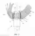 Fig. 11 - METHOD AND APPARATUS FOR SUTURELESSLY CONNECTING A CONDUIT TO A HOLLOW ORGAN