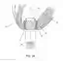 Fig. 24 - METHOD AND APPARATUS FOR SUTURELESSLY CONNECTING A CONDUIT TO A HOLLOW ORGAN