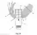 Fig. 25 - METHOD AND APPARATUS FOR SUTURELESSLY CONNECTING A CONDUIT TO A HOLLOW ORGAN
