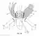 Fig. 40 - METHOD AND APPARATUS FOR SUTURELESSLY CONNECTING A CONDUIT TO A HOLLOW ORGAN