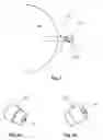 Fig. 04 - Lumen clearing valve for glaucoma drainage device
