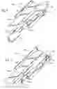 Fig. 06 - Lumen clearing valve for glaucoma drainage device