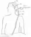 Fig. 01 - Method and apparatus for controlling intracranial pressure