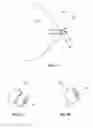 Fig. 04 - Glaucoma drainage device with pump