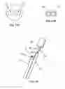 Fig. 09 - Glaucoma drainage device with pump