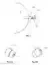 Fig. 04 - Power saving glaucoma drainage device