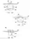 Fig. 07 - System and method for modulated surgical procedure irrigation and aspiration