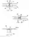 Fig. 09 - System and method for modulated surgical procedure irrigation and aspiration