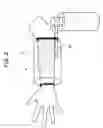 Fig. 03 - CARBON DIOXIDE EXTERNAL ADMINISTRATION DEVICE