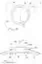 Fig. 04 - Surgical access apparatus and method