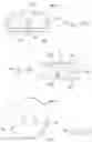 Fig. 09 - Surgical access apparatus and method