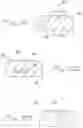Fig. 10 - Surgical access apparatus and method
