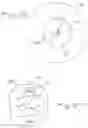 Fig. 12 - Surgical access apparatus and method
