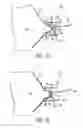 Fig. 10 - Highly efficient breastpump and system for expressing breastmilk