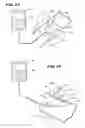 Fig. 02 - Systems and methods for applying a selected treatment agent into contact with tissue to treat sphincter dysfunction