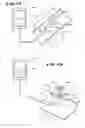 Fig. 03 - Systems and methods for applying a selected treatment agent into contact with tissue to treat sphincter dysfunction