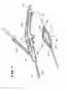 Fig. 07 - Systems and methods for applying a selected treatment agent into contact with tissue to treat sphincter dysfunction