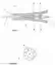 Fig. 06 - Spinal cannula having liquor detection