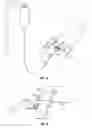 Fig. 02 - DEVICES AND METHODS FOR SIGNALING WHEN ACTION IS DUE IN RELATION TO A MEDICAL DEVICE