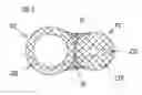 Fig. 04 - BALLOON FIXATED CATHETER