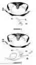 Fig. 05 - BALLOON FIXATED CATHETER