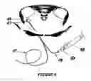 Fig. 06 - BALLOON FIXATED CATHETER