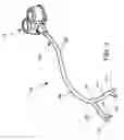 Fig. 04 - BRANCHED CATHETER TIP