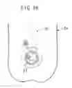 Fig. 17 - Catheter for coronary artery and engaging method therefor