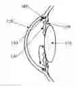 Fig. 01 - Intraocular pressure sensor with external pressure compensation