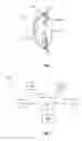 Fig. 02 - Intraocular pressure sensor with external pressure compensation