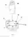 Fig. 07 - Percutaneous and laparoscopic surgical instrument