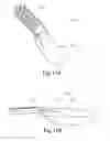 Fig. 14 - Surgical rasping systems and methods