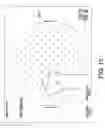 Fig. 11 - SYSTEMS USING IMAGING DATA TO FACILITATE SURGICAL PROCEDURES