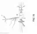 Fig. 16 - SYSTEMS USING IMAGING DATA TO FACILITATE SURGICAL PROCEDURES