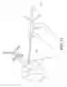 Fig. 18 - SYSTEMS USING IMAGING DATA TO FACILITATE SURGICAL PROCEDURES