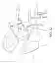 Fig. 33 - SYSTEMS USING IMAGING DATA TO FACILITATE SURGICAL PROCEDURES