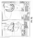 Fig. 51 - SYSTEMS USING IMAGING DATA TO FACILITATE SURGICAL PROCEDURES