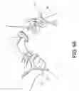 Fig. 57 - SYSTEMS USING IMAGING DATA TO FACILITATE SURGICAL PROCEDURES