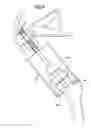 Fig. 07 - METHOD OF APPLYING A FEMORAL HEAD RESURFACING PROSTHESIS