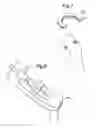 Fig. 08 - METHOD OF APPLYING A FEMORAL HEAD RESURFACING PROSTHESIS
