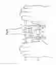 Fig. 09 - METHOD OF APPLYING A FEMORAL HEAD RESURFACING PROSTHESIS