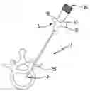 Fig. 01 - Surgical device