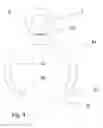 Fig. 04 - Apparatus for removing an object from a lumen