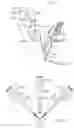 Fig. 06 - Curved cannula surgical system