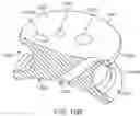 Fig. 32 - Curved cannula surgical system